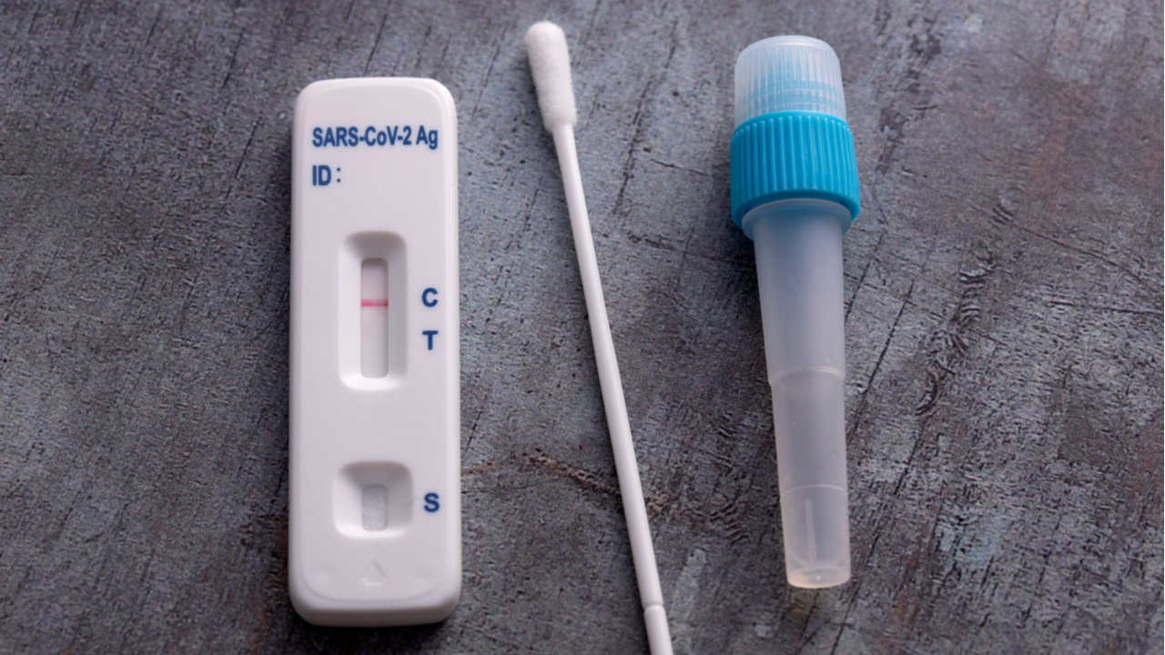 AESKU RAPID Sars-CoV-2 Antigen Test User Guide