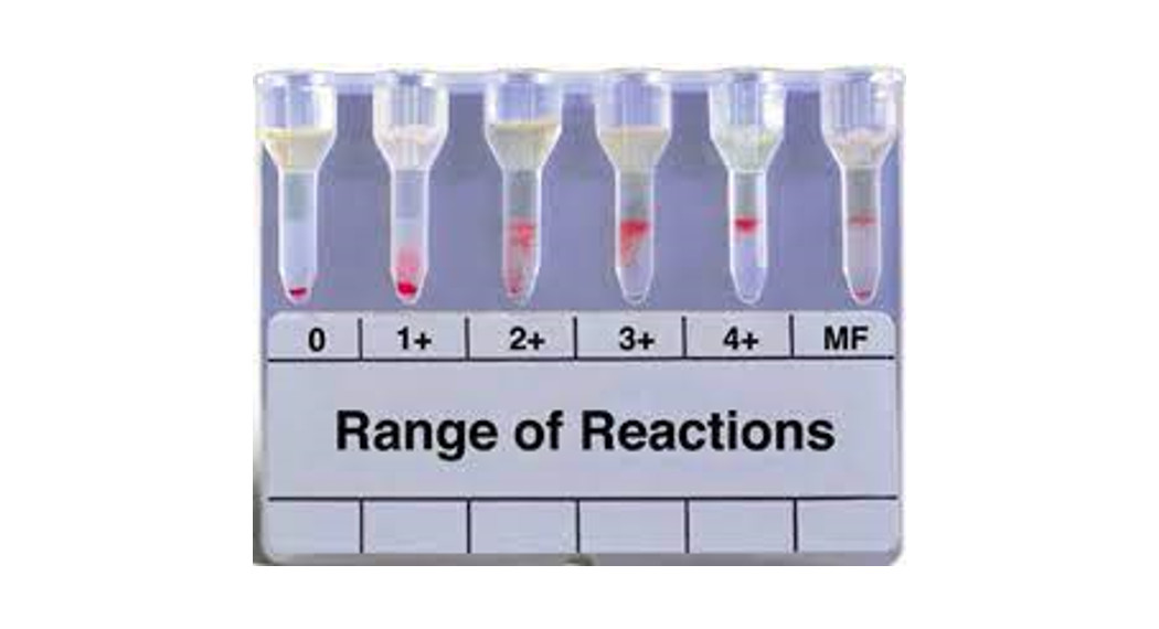 Micro Typing System MTS084024 Anti-Human Globulin Anti-IgG MTS Anti-IgG Card Instruction Manual